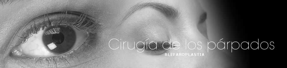 Blefaroplastia o cirugía de los párpados